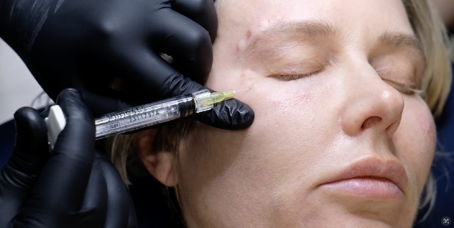 Trattamento con polinucleotidi